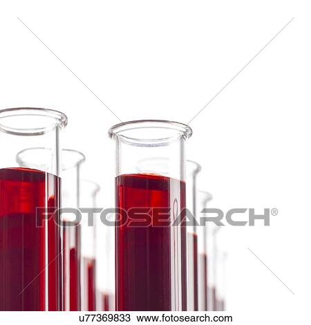 Blood samples in test tubes. View Large Illustration Drawing - Blood samples in test tubes.. Fotosearch
