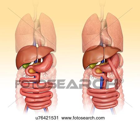 Computer illustration of the abdomen before (left) and after (right) a gastric bypass. View Large Illustration Clip Art - Computer illustration of the abdomen before (left) and after (right) a gastric bypass.. Fotosearch