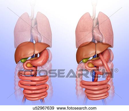 Stock Illustration - Computer illustration of the abdomen before (left) and after (right) a gastric bypass.. Fotosearch