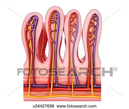Stock Illustration - Cross section of a tumour in the small intestine, computer illustration.. Fotosearch