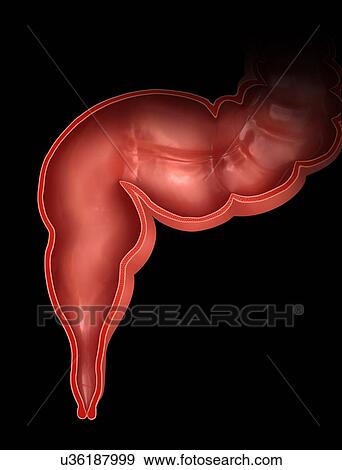 Stock Illustration - Cross section of the human colon, computer artwork.. Fotosearch