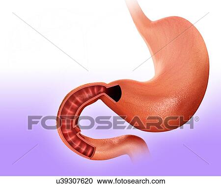 Clipart - Cross section of the human small intestine and stomach, computer artwork.. Fotosearch