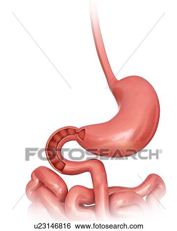 Stock Illustration - Cross section of the human small intestine and stomach, computer illustration.. Fotosearch