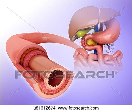 Cross section of the human small intestinal wall, computer artwork. View Large Illustration Stock Illustration - Cross section of the human small intestinal wall, computer artwork.. Fotosearch