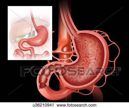 Clip Art - Cross section of the human stomach, computer illustration.. Fotosearch