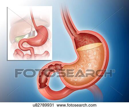 Clip Art - Cross section of the human stomach showing acidity levels, computer illustration.. Fotosearch