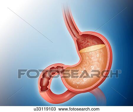 Cross section of the human stomach showing acidity levels, computer illustration. View Large Illustration Drawing - Cross section of the human stomach showing acidity levels, computer illustration.. Fotosearch