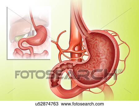 Cross section of the human stomach, computer illustration. View Large Illustration Drawing - Cross section of the human stomach, computer illustration.. Fotosearch