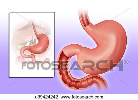 Cross section of the human stomach, computer illustration. View Large Illustration Drawing - Cross section of the human stomach, computer illustration.. Fotosearch