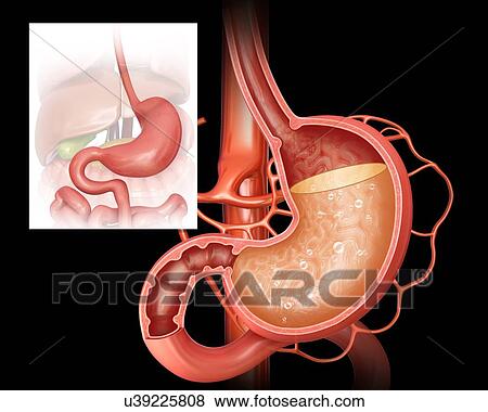 Stock Illustration - Cross section of the human stomach showing acidity levels, computer artwork.. Fotosearch