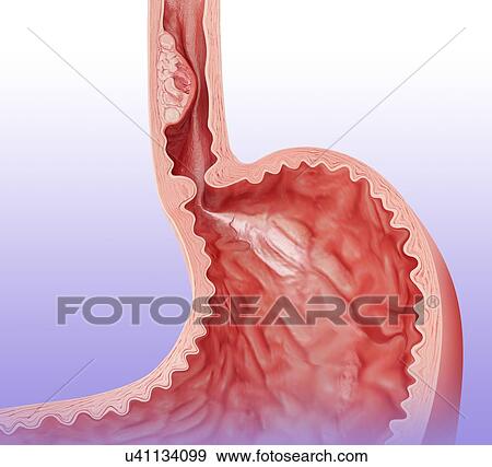 Stock Illustration - Cross section of the human stomach, computer illustration.. Fotosearch