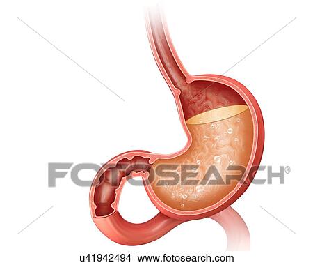 Stock Illustration - Cross section of the human stomach showing acidity levels, computer artwork.. Fotosearch