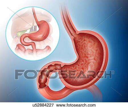 Cross section of the human stomach, computer artwork. View Large Illustration Stock Illustration - Cross section of the human stomach, computer artwork.. Fotosearch