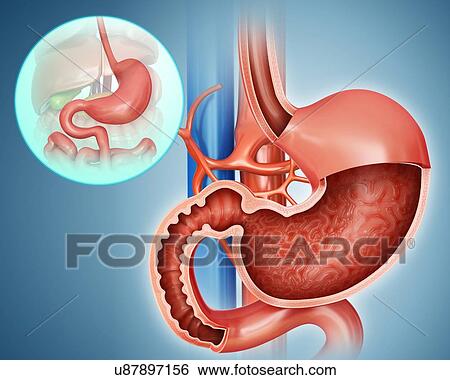 Cross section of the human stomach, computer artwork. View Large Illustration Stock Illustration - Cross section of the human stomach, computer artwork.. Fotosearch