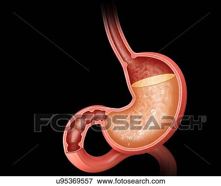 Stock Illustration - Cross section of the human stomach showing acidity levels, computer artwork.. Fotosearch