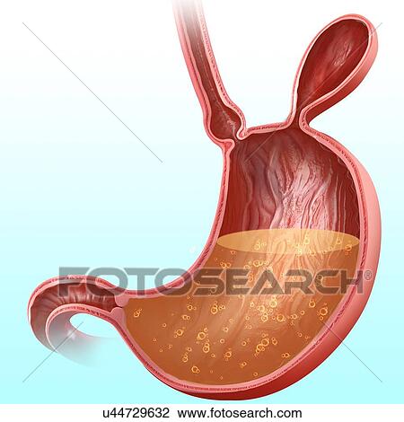 Cross section of the human stomach with a hernia, computer artwork. View Large Illustration Drawing - Cross section of the human stomach with a hernia, computer artwork.. Fotosearch