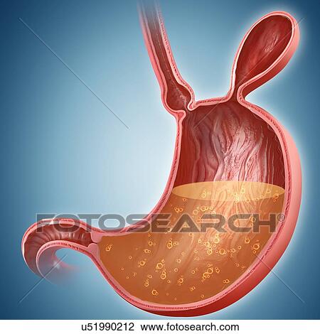 Drawing - Cross section of the human stomach with a hernia, computer illustration.. Fotosearch