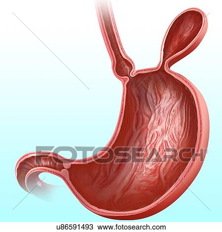 Cross section of the human stomach with a hernia, computer illustration. View Large Illustration Drawing - Cross section of the human stomach with a hernia, computer illustration.. Fotosearch