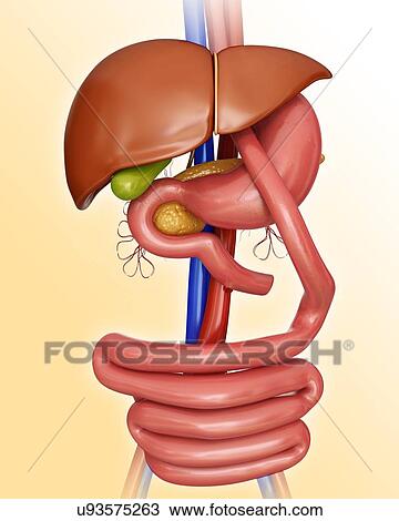 Drawing - Gastric bypass, computer artwork.. Fotosearch