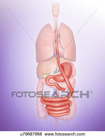 Stock Illustration - Gastric bypass, computer artwork.. Fotosearch