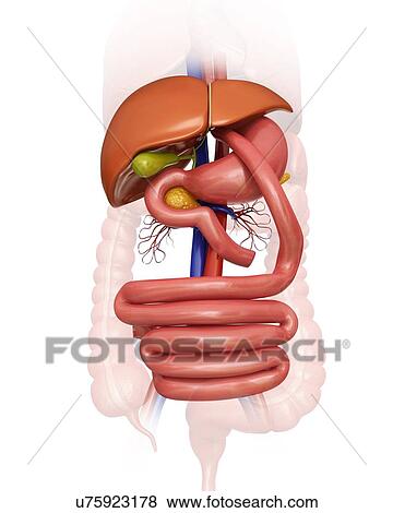 Stock Illustration - Gastric bypass, computer illustration.. Fotosearch