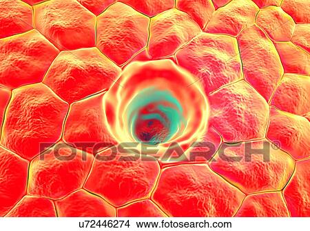Stock Illustration - Hair follicle, computer illustration.. Fotosearch