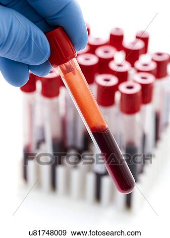 Hand holding a blood sample in a test tube. View Large Illustration Stock Illustration - Hand holding a blood sample in a test tube.. Fotosearch