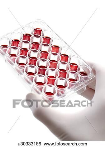 Hand holding a multiwell tray containing blood samples. View Large Illustration Stock Illustration - Hand holding a multiwell tray containing blood samples.. Fotosearch