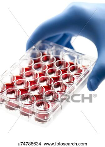 Hand holding a multiwell tray containing blood samples. View Large Illustration Stock Illustration - Hand holding a multiwell tray containing blood samples.. Fotosearch