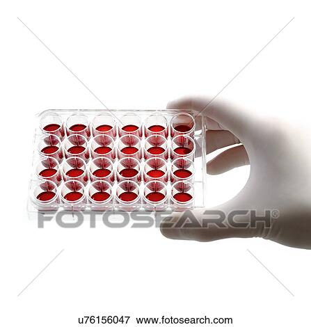 Hand holding a multiwell tray containing blood samples. View Large Illustration Stock Illustration - Hand holding a multiwell tray containing blood samples.. Fotosearch
