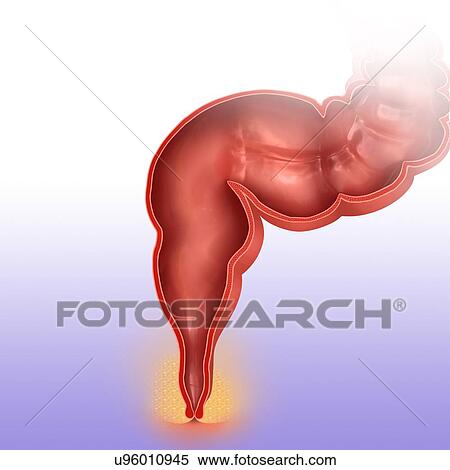 Human colon, computer illustration. View Large Illustration Stock Illustration - Human colon, computer illustration.. Fotosearch