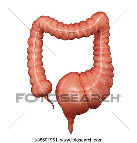 Clip Art - Human large intestine showing a megacolon, computer artwork.. Fotosearch