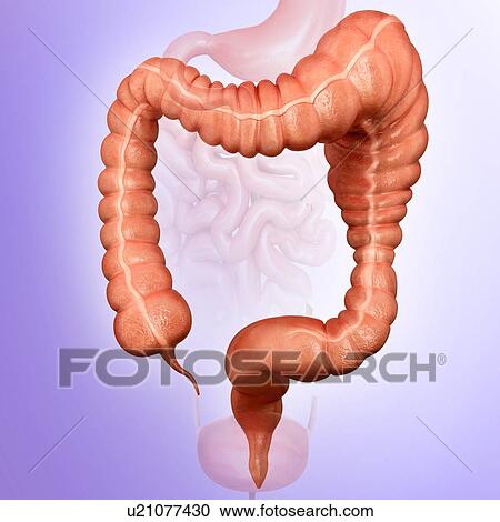 Human large intestine showing a megacolon, computer illustration. View Large Illustration Clipart - Human large intestine showing a megacolon, computer illustration.. Fotosearch
