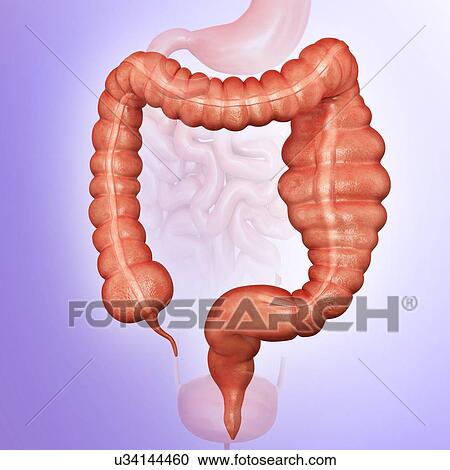 Clipart - Human large intestine showing a megacolon, computer illustration.. Fotosearch