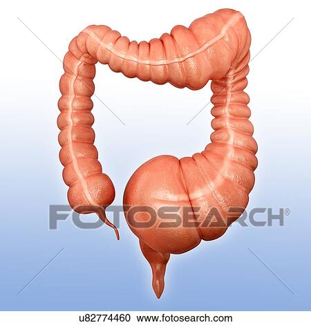 Clipart - Human large intestine showing a megacolon, computer illustration.. Fotosearch