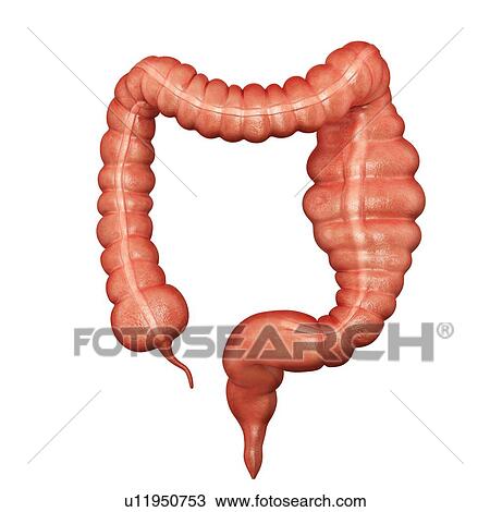 Human Large Intestine Showing A Megacolon Computer Illustration Drawing U Fotosearch