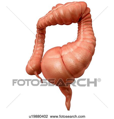Drawing - Human large intestine showing a megacolon, computer artwork.. Fotosearch