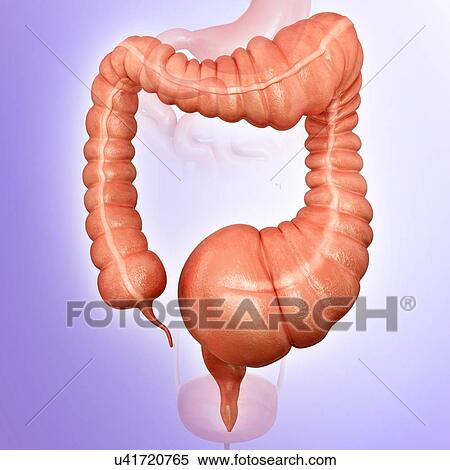 Stock Illustration - Human large intestine showing a megacolon, computer illustration.. Fotosearch