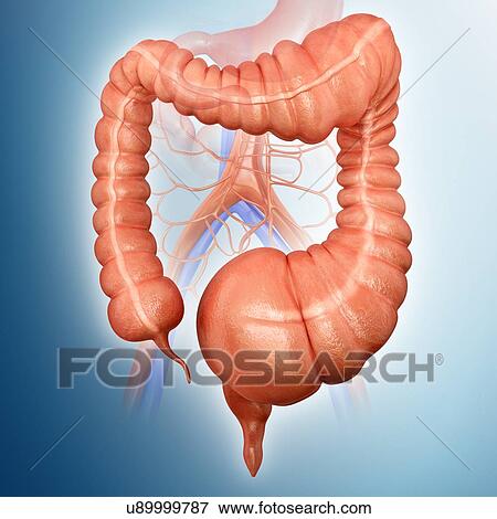 Stock Illustration - Human large intestine showing a megacolon, computer illustration.. Fotosearch
