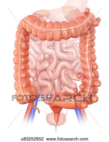 Human large intestine showing diverticulitis, computer illustration. View Large Illustration Drawing - Human large intestine showing diverticulitis, computer illustration.. Fotosearch