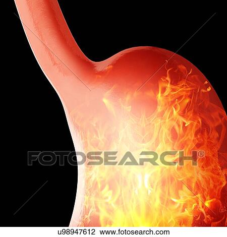 Human stomach, computer illustration. View Large Illustration Drawing - Human stomach, computer illustration.. Fotosearch