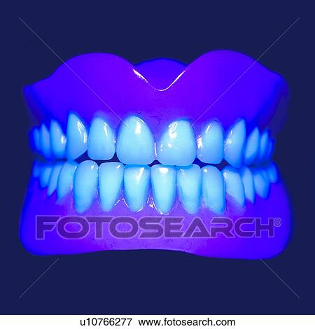 Stock Illustration - Model teeth in UV (ultraviolet) light, close up.. Fotosearch