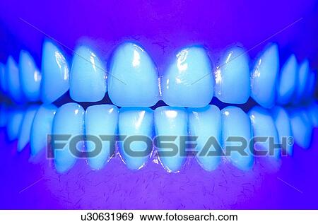 Model teeth in UV (ultraviolet) light, close up. View Large Illustration Stock Illustration - Model teeth in UV (ultraviolet) light, close up.. Fotosearch