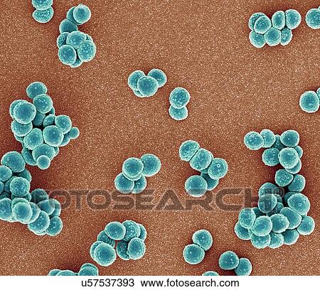 Drawing - MRSA bacteria. Coloured scanning electron micrograph (SEM) of methicillin-resistant Staphylococcus aureus (MRSA) bacteria (round). MRSA is a Gram-positive, round (coccus) bacterium that is resistant to many commonly prescribed antibiotics.. Fotosearch
