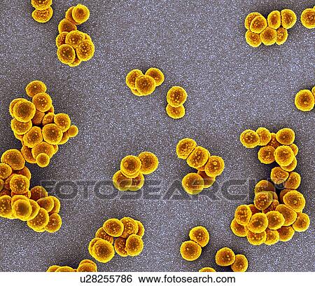 MRSA bacteria. Coloured scanning electron micrograph (SEM) of methicillin-resistant Staphylococcus aureus (MRSA) bacteria (round). MRSA is a Gram-positive, round (coccus) bacterium that is resistant to many commonly prescribed antibiotics. View Large Illustration Stock Illustration - MRSA bacteria. Coloured scanning electron micrograph (SEM) of methicillin-resistant Staphylococcus aureus (MRSA) bacteria (round). MRSA is a Gram-positive, round (coccus) bacterium that is resistant to many commonly prescribed antibiotics.. Fotosearch