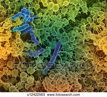 Drawing - Oral bacteria. Coloured scanning electron micrograph (SEM) of mixed oral bacteria (Streptococcus, round) and bacilli bacteria, with the intercellular strands being eDNA (extracellular deoxyribonucleic acid).. Fotosearch