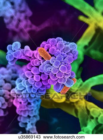 Drawing - Oral bacteria. Coloured scanning electron micrograph (SEM) of mixed oral bacteria (Streptococcus, round) with some bacilli bacteria (rod-shaped).. Fotosearch