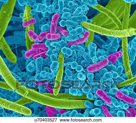Stock Illustration - Oral bacteria. Coloured scanning electron micrograph (SEM) of mixed oral bacteria, consisting mostly of rod-shaped bacteria (bacilli) and filamentous bacteria.. Fotosearch