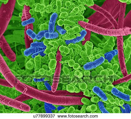 Oral bacteria. Coloured scanning electron micrograph (SEM) of mixed oral bacteria, consisting mostly of rod-shaped bacteria (bacilli) and filamentous bacteria. View Large Illustration Stock Illustration - Oral bacteria. Coloured scanning electron micrograph (SEM) of mixed oral bacteria, consisting mostly of rod-shaped bacteria (bacilli) and filamentous bacteria.. Fotosearch