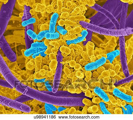 Stock Illustration - Oral bacteria. Coloured scanning electron micrograph (SEM) of mixed oral bacteria, consisting mostly of rod-shaped bacteria (bacilli) and filamentous bacteria.. Fotosearch